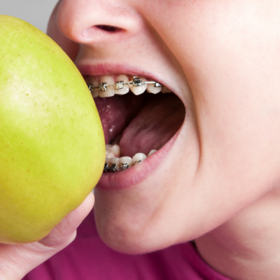 The Link Between Nutrition and Dental Health