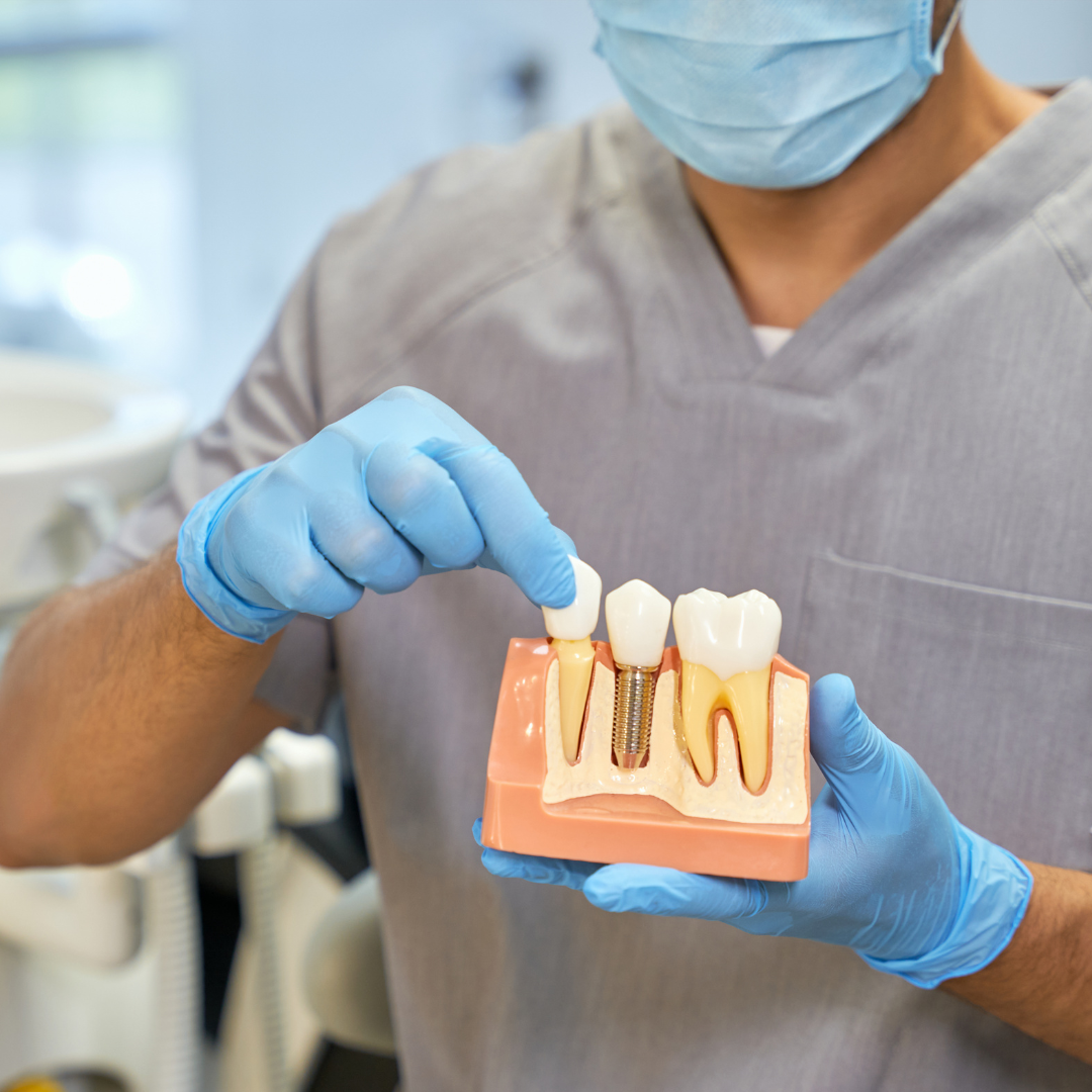 Restore Your Smile with Dental Implants That Look and Feel Natural