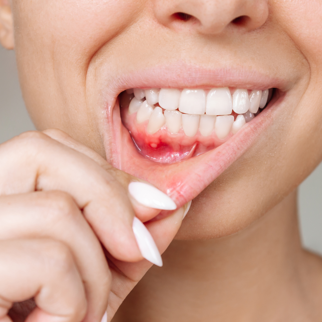 Gum Disease and Your Overall Health: The Mouth-Body Connection