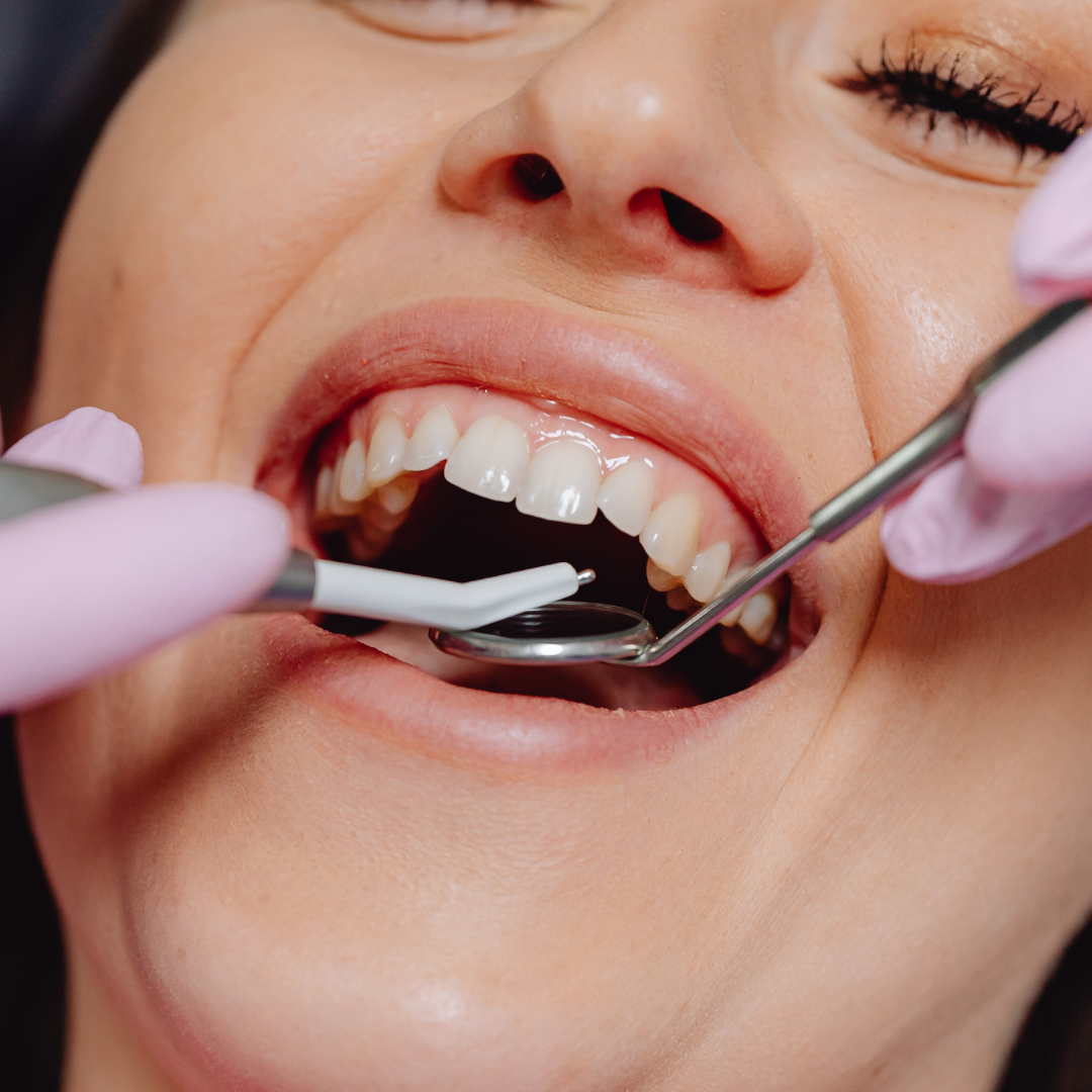 Reset Your Smile: Simple January Habits That Keep Cavities Away All Year