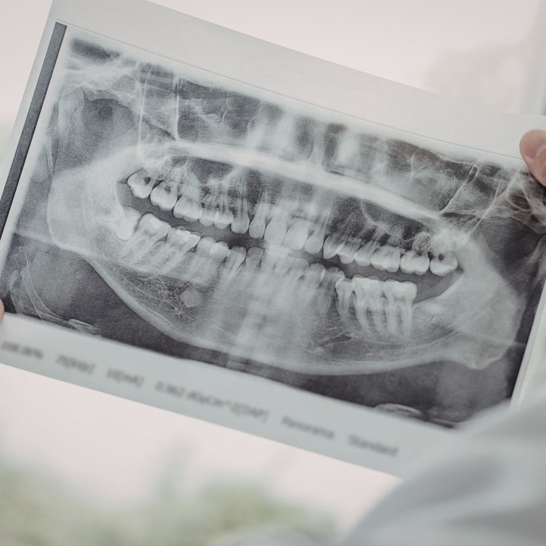 A Parent’s Guide to Your Child’s First Dental X-Ray