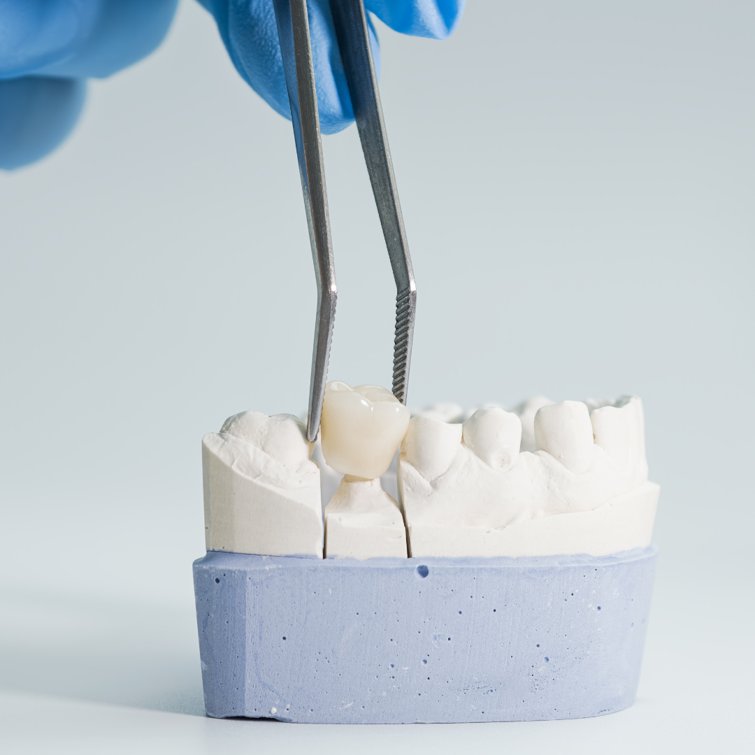 5 Signs You May Be Grinding Your Teeth at Night