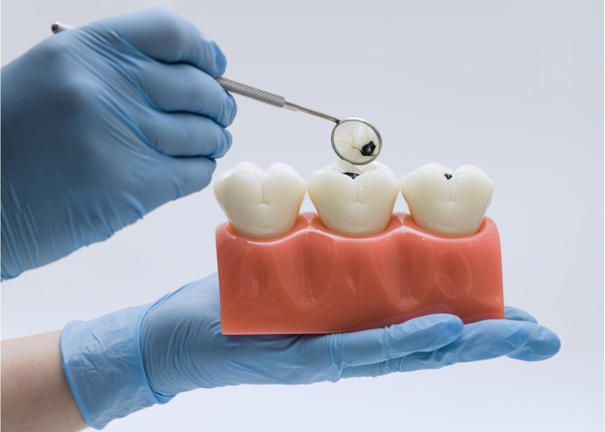 How to Prevent Cavities During Candy Season